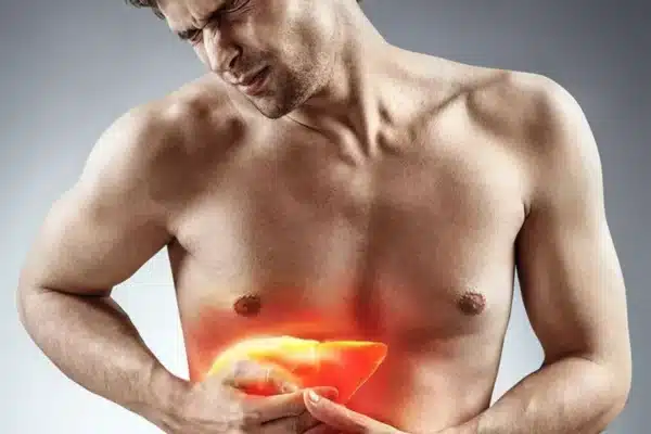 How You Can Prevent Liver Damage From Steroids