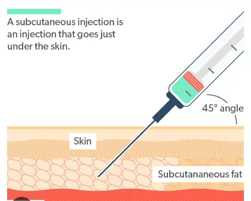 subcutaneous injection technique